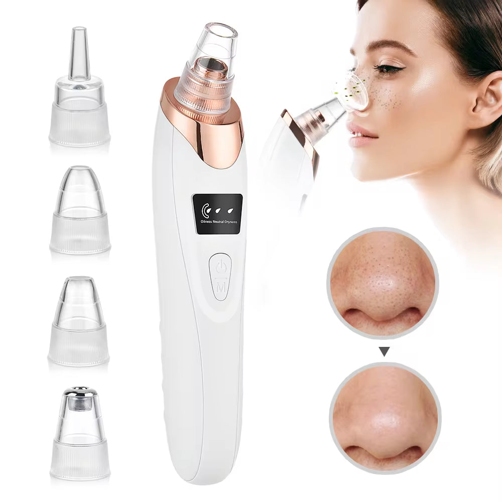 Beauty Electric Blackhead Remover Facial Cleaner Black Point Vacuum Suction Black Head Dots Remover Extractor Skin Care Tools